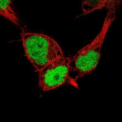 Immunocytochemistry/ Immunofluorescence: Nanog Antibody (CL5803) [NBP2-61428]