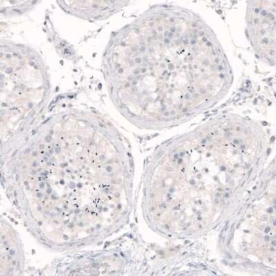 Immunohistochemistry-Paraffin: Nanog Antibody (CL5810) [NBP2-61429]