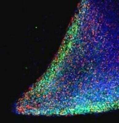 Immunocytochemistry/ Immunofluorescence: Nanog Antibody [NB110-40660]
