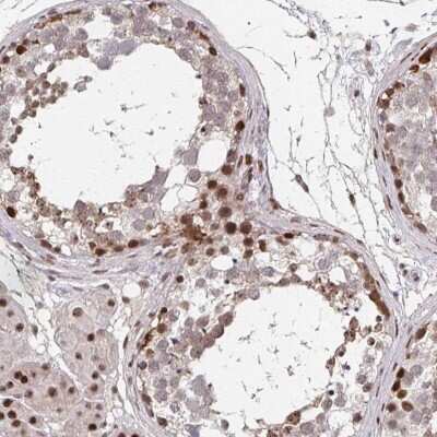 Immunohistochemistry: Nanos3 Antibody [NBP2-38011]