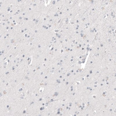 Immunohistochemistry-Paraffin: Napsin A Antibody (CL12954) [NBP3-18551]