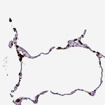 Immunohistochemistry-Paraffin: Napsin A Antibody [NBP2-33499]