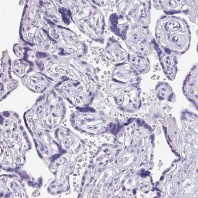 Immunohistochemistry-Paraffin: Napsin A Antibody [NBP2-33499]