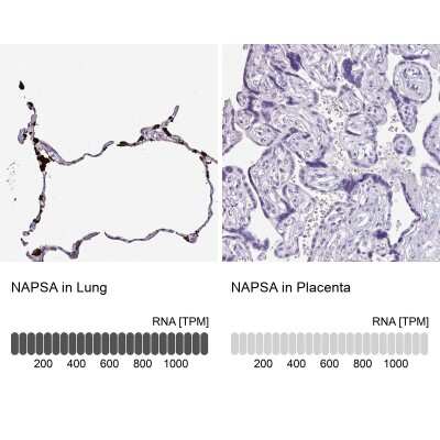 Immunohistochemistry-Paraffin: Napsin A Antibody [NBP2-33499]