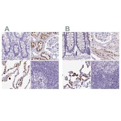 Immunohistochemistry-Paraffin: Napsin A Antibody [NBP2-33499]