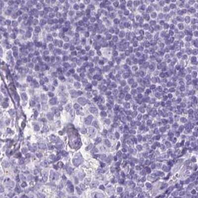 Immunohistochemistry-Paraffin: Napsin A Antibody [NBP2-33499]