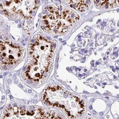 Immunohistochemistry-Paraffin: Napsin A Antibody [NBP2-33499]