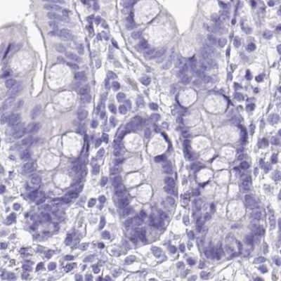 Immunohistochemistry-Paraffin: Napsin A Antibody [NBP2-33499]