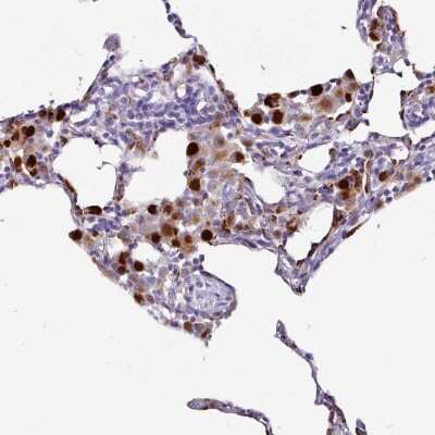 Immunohistochemistry-Paraffin: Napsin A Antibody [NBP2-34213]