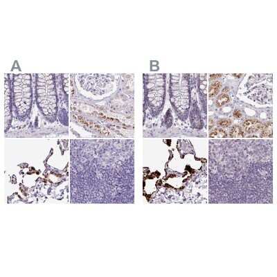 Immunohistochemistry-Paraffin: Napsin A Antibody [NBP2-34213]