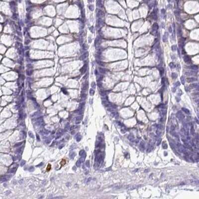 Immunohistochemistry-Paraffin: Napsin A Antibody [NBP2-34213]