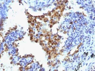 Immunohistochemistry-Paraffin: Napsin A Antibody (NAPSA/1238 + NAPSA/1239) - BSA Free [NBP2-54391]