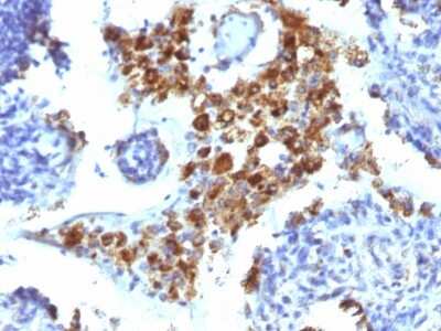 Immunohistochemistry-Paraffin: Napsin A Antibody (NAPSA/1238) [NBP2-45244]