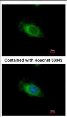 Immunocytochemistry/ Immunofluorescence: Nardilysin Antibody [NBP2-19473]