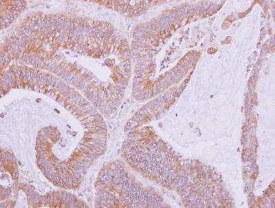 Immunohistochemistry-Paraffin: Nardilysin Antibody [NBP2-19473]