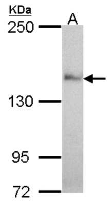 Western Blot: Nardilysin Antibody [NBP2-19472]