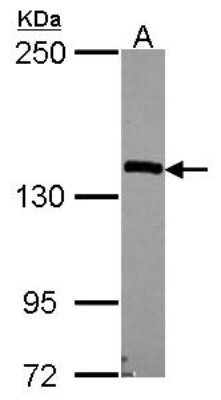 Western Blot: Nardilysin Antibody [NBP2-19473]