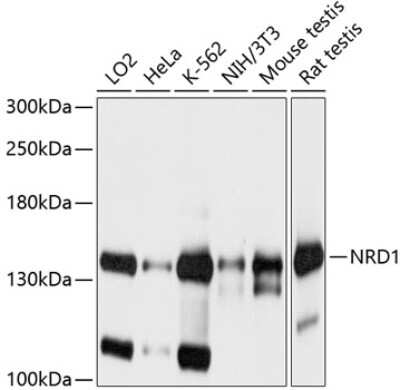 Western Blot: Nardilysin AntibodyBSA Free [NBP2-93058]