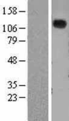 Western Blot: NPRA/NPR1 Overexpression Lysate [NBL1-13754]