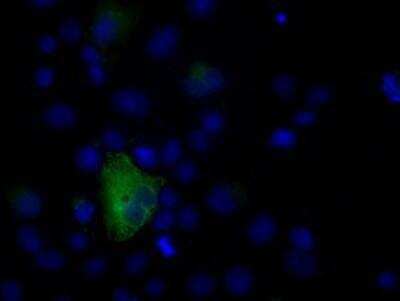 Immunocytochemistry/ Immunofluorescence: Natriuretic Peptide Receptor C Antibody (OTI4C3) [NBP2-02401]