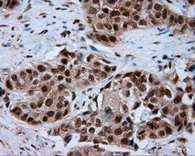 Immunohistochemistry-Paraffin: Natriuretic Peptide Receptor C Antibody (OTI4C3) [NBP2-02401]