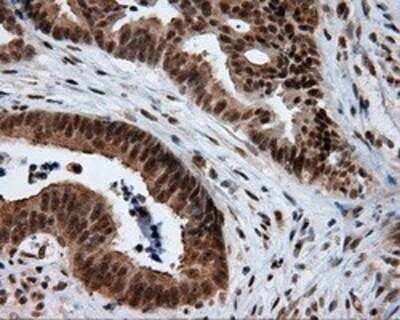 Immunohistochemistry-Paraffin: Natriuretic Peptide Receptor C Antibody (OTI4C3) [NBP2-02401]