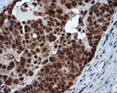 Immunohistochemistry-Paraffin: Natriuretic Peptide Receptor C Antibody (OTI4C3) [NBP2-02401]