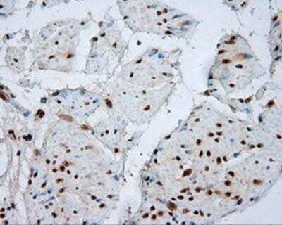 Immunohistochemistry-Paraffin: Natriuretic Peptide Receptor C Antibody (OTI4C3) [NBP2-02401]