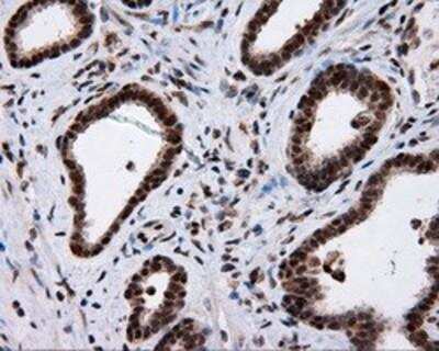 Immunohistochemistry-Paraffin: Natriuretic Peptide Receptor C Antibody (OTI4C3) [NBP2-02401]