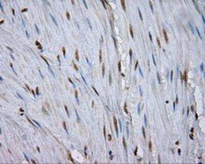 Immunohistochemistry-Paraffin: Natriuretic Peptide Receptor C Antibody (OTI4C3) [NBP2-02401]