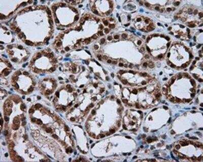 Immunohistochemistry-Paraffin: Natriuretic Peptide Receptor C Antibody (OTI4C3) [NBP2-02401]