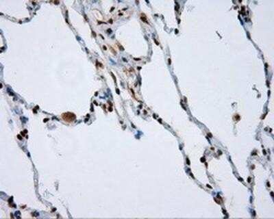 Immunohistochemistry-Paraffin: Natriuretic Peptide Receptor C Antibody (OTI4C3) [NBP2-02401]