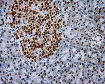 Immunohistochemistry-Paraffin: Natriuretic Peptide Receptor C Antibody (OTI4C3) [NBP2-02401]