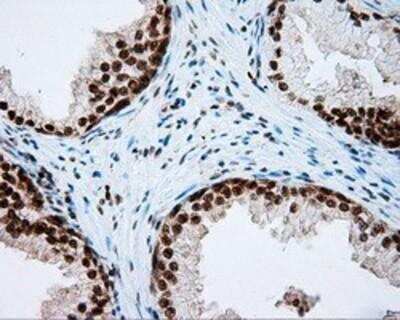 Immunohistochemistry-Paraffin: Natriuretic Peptide Receptor C Antibody (OTI4C3) [NBP2-02401]
