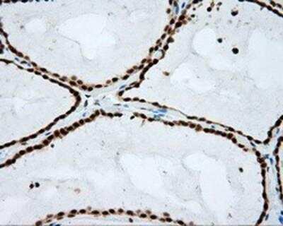 Immunohistochemistry-Paraffin: Natriuretic Peptide Receptor C Antibody (OTI4C3) [NBP2-02401]