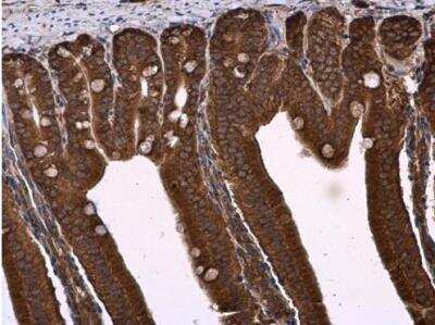 Immunohistochemistry-Paraffin: Natriuretic Peptide Receptor C Antibody [NBP1-31365]