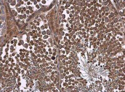 Immunohistochemistry-Paraffin: Natriuretic Peptide Receptor C Antibody [NBP1-31365]