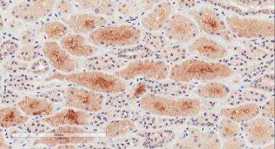 Immunohistochemistry-Paraffin: Natriuretic Peptide Receptor C Antibody [NBP1-97777]