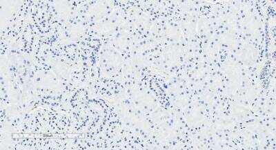 Immunohistochemistry-Paraffin: Natriuretic Peptide Receptor C Antibody [NBP1-97777]
