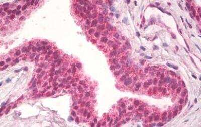 Immunohistochemistry-Paraffin: Natriuretic Peptide Receptor C Antibody [NBP1-97777]
