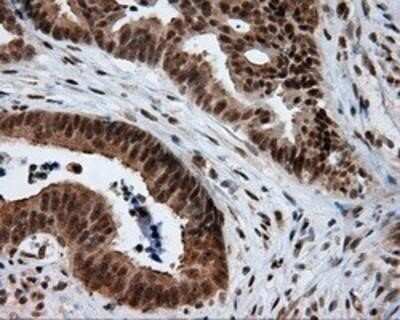 Immunohistochemistry: Natriuretic Peptide Receptor C Antibody (OTI4C3) - Azide and BSA Free [NBP2-72881]