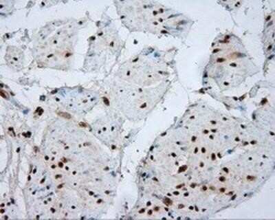 Immunohistochemistry: Natriuretic Peptide Receptor C Antibody (OTI4C3) - Azide and BSA Free [NBP2-72881]