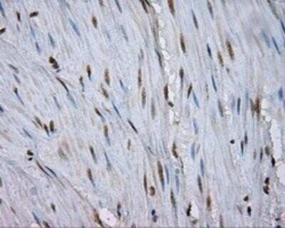 Immunohistochemistry: Natriuretic Peptide Receptor C Antibody (OTI4C3) - Azide and BSA Free [NBP2-72881]