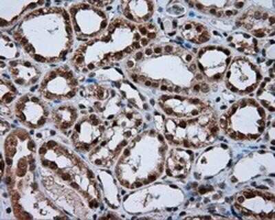 Immunohistochemistry: Natriuretic Peptide Receptor C Antibody (OTI4C3) - Azide and BSA Free [NBP2-72881]