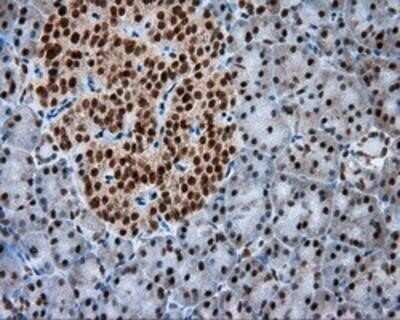 Immunohistochemistry: Natriuretic Peptide Receptor C Antibody (OTI4C3) - Azide and BSA Free [NBP2-72881]