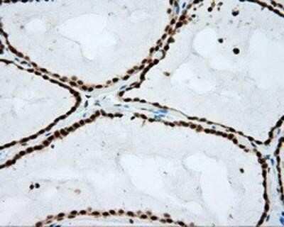 Immunohistochemistry: Natriuretic Peptide Receptor C Antibody (OTI4C3) - Azide and BSA Free [NBP2-72881]