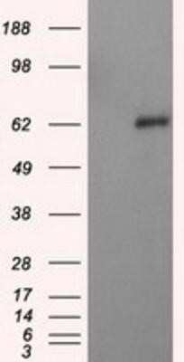 Western Blot: Natriuretic Peptide Receptor C Antibody (OTI4C3)Azide and BSA Free [NBP2-72881]