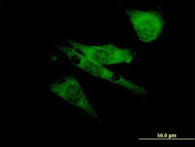 Immunocytochemistry/ Immunofluorescence: Nav1.6 Antibody (4G7) [H00006334-M04]