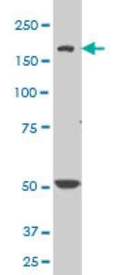 Western Blot: Nav1.6 Antibody (4G7) [H00006334-M04]