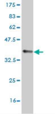 Western Blot: Nav1.6 Antibody (4G7) [H00006334-M04]